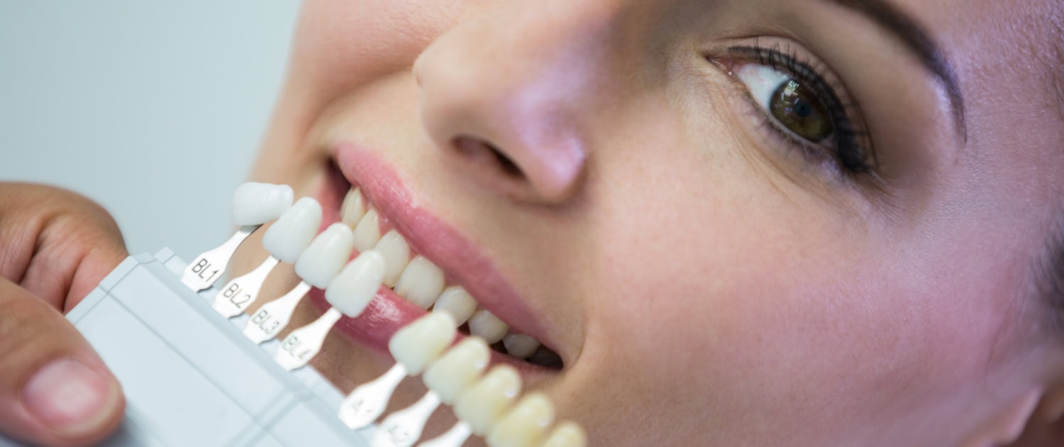 Dentist examining female patient with teeth shades at dental clinic