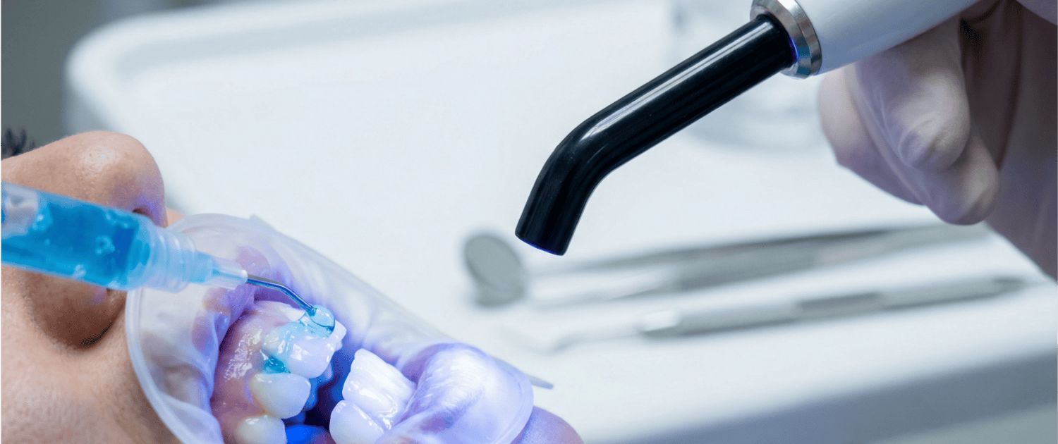 new_01_whitening_gel_application