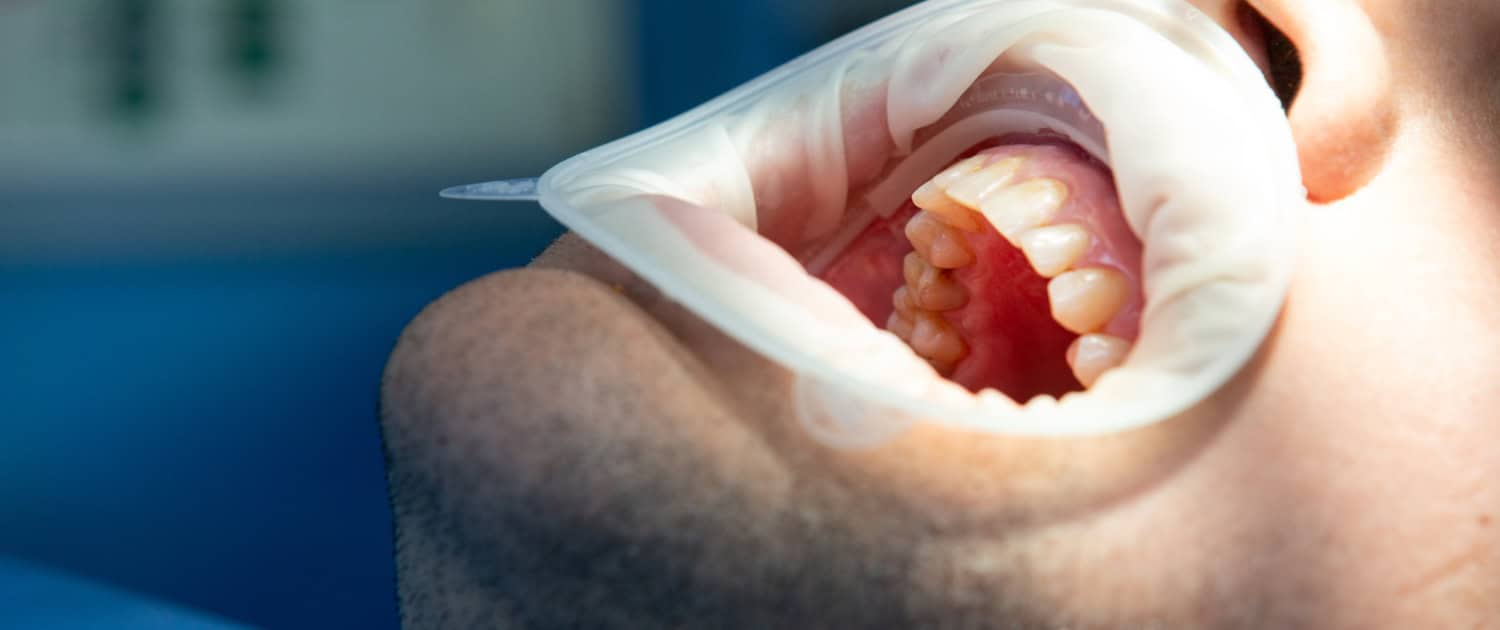 pacient in dental clinic while operation